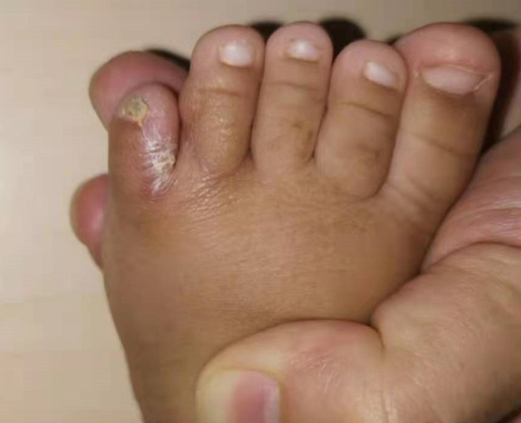 B体育-灰熊JJJ正式接受脚趾手术三个月后重新评估的简单介绍